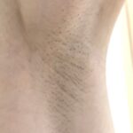 【春にむけて】ムダ毛処理をして4月からいいスタートをしましょう